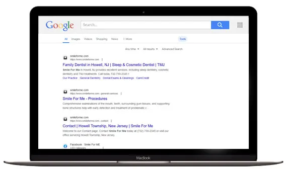 SEO_requirements